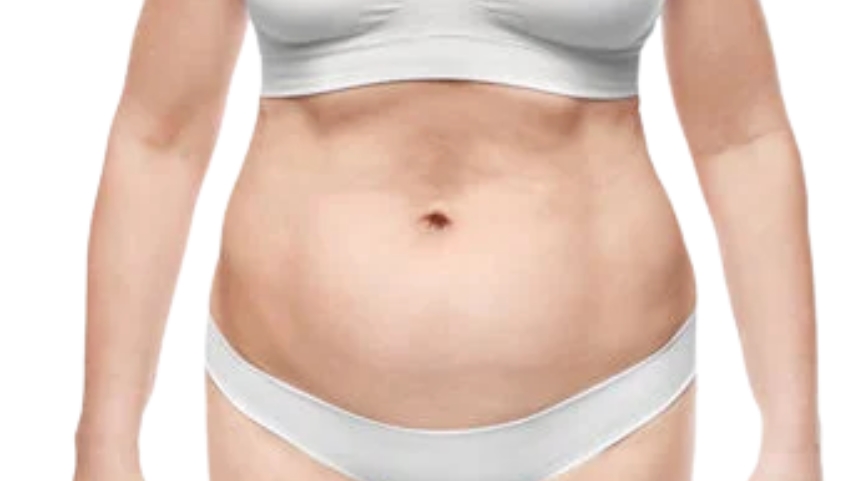 Face with loose skin before radio frequency tightening